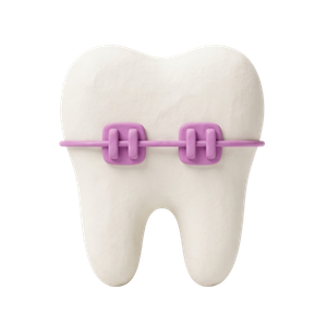 Teeth Braces