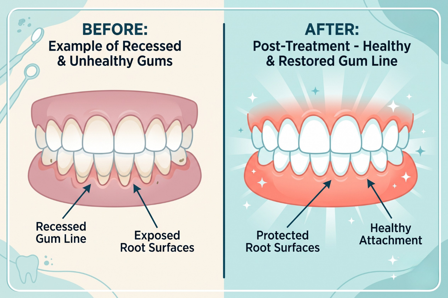 smile-lane-best-dentist-clinic-in-Gum-Surgeries-treatment-kolkata
