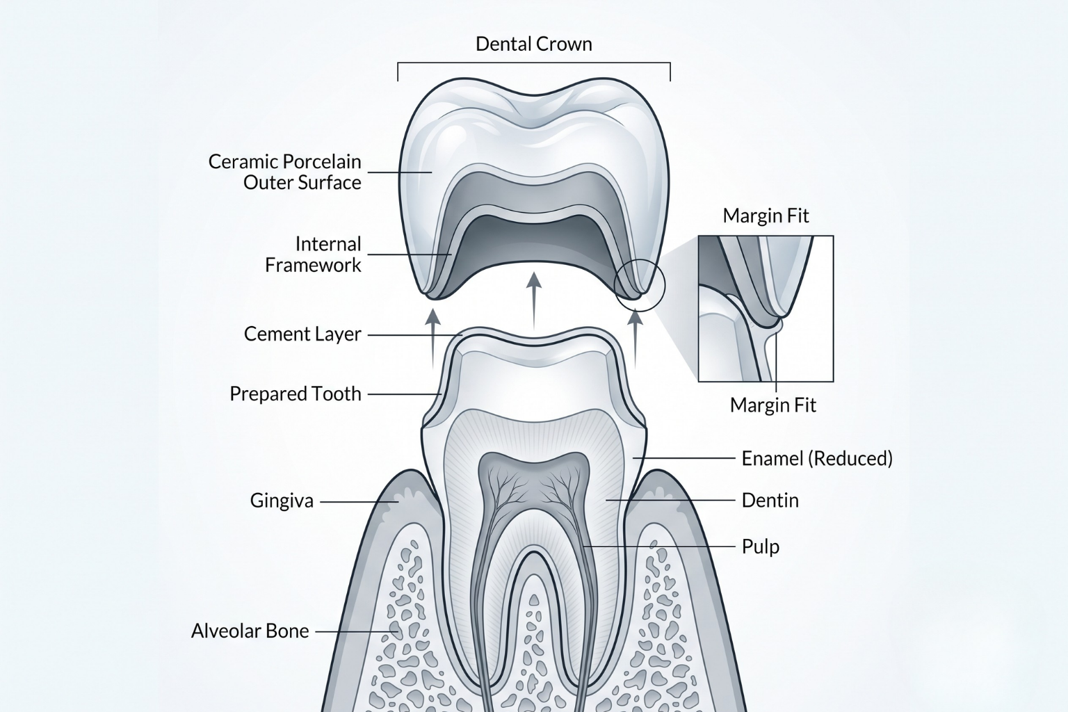 smile-lane-best-dentist-clinic-in-Tooth-Crown-treatment-kolkata