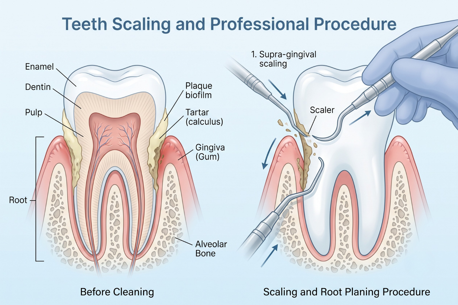 smile-lane-best-dentist-clinic-in-teeth-scaling-treatment-2-kolkata